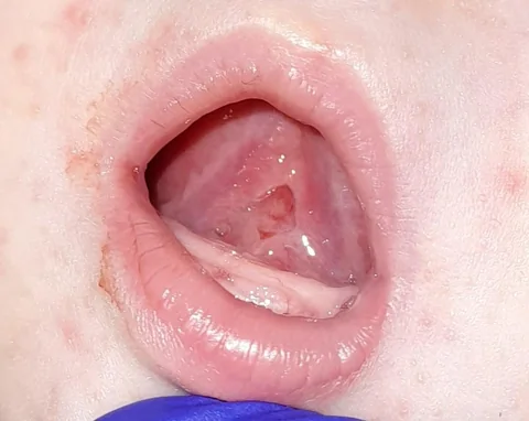 10 days old — after the procedure