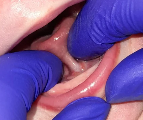 10 days old — before the procedure
