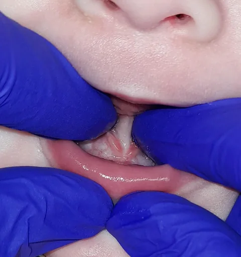 13 weeks old — before the procedure