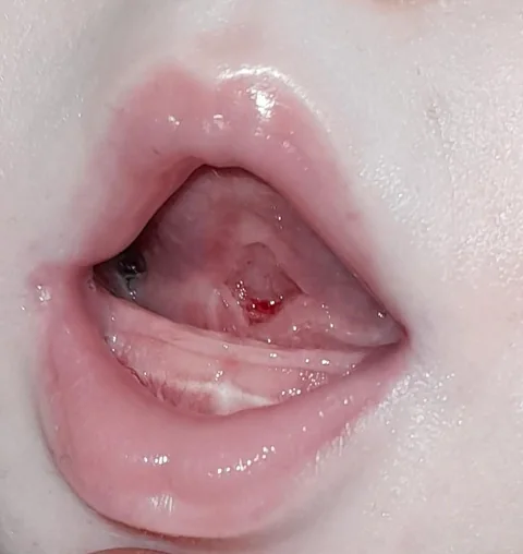 15 weeks old — after the procedure