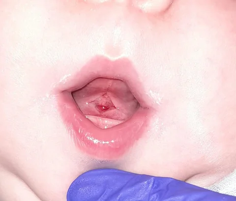 19 weeks old — after the procedure